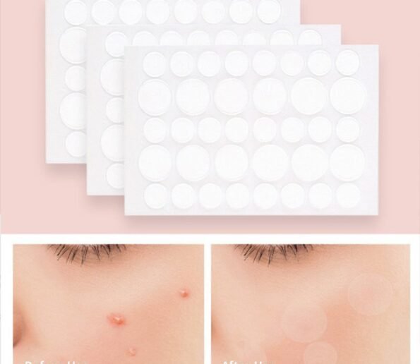 36 Patches Acne Pimple Patch Stickers Acne Pimple Remover Tool Absorb Pus And Oil Acne Patch 595x516